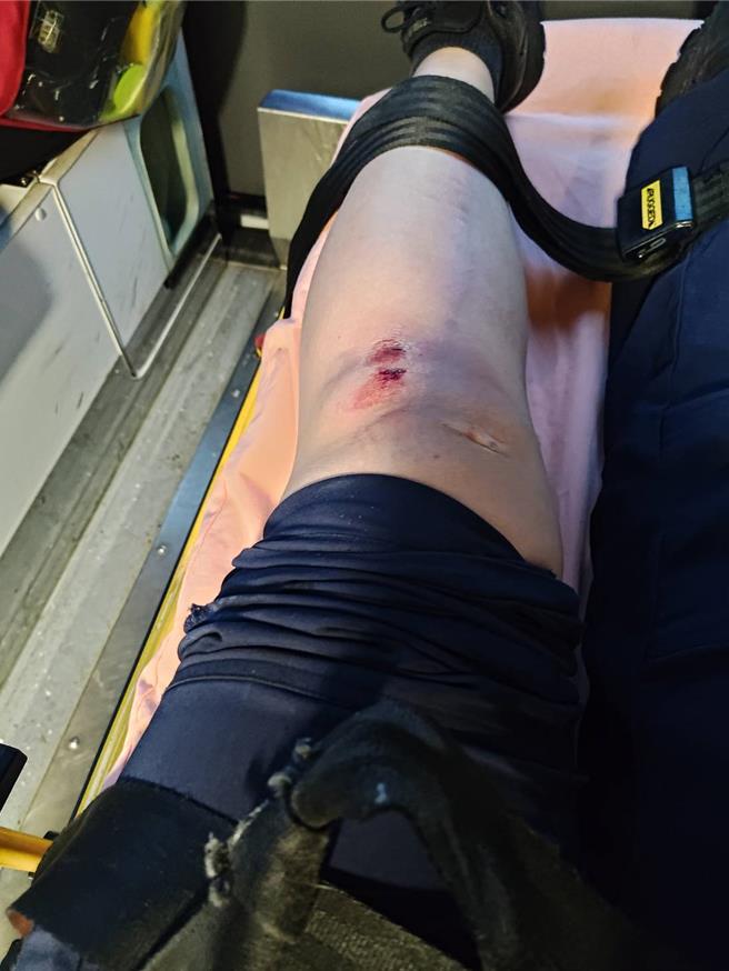 吴姓女警遭偷车贼拖行数公尺，造成手脚擦挫伤、肩拉伤等。（警方提供）