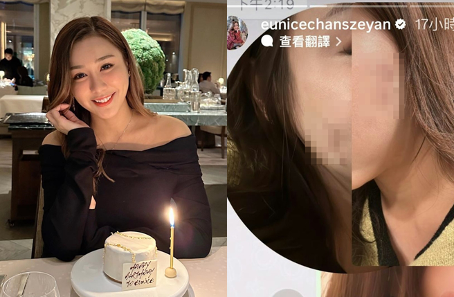 陈诗欣自曝被毁容。（图／翻摄自eunicechanszeyan IG）