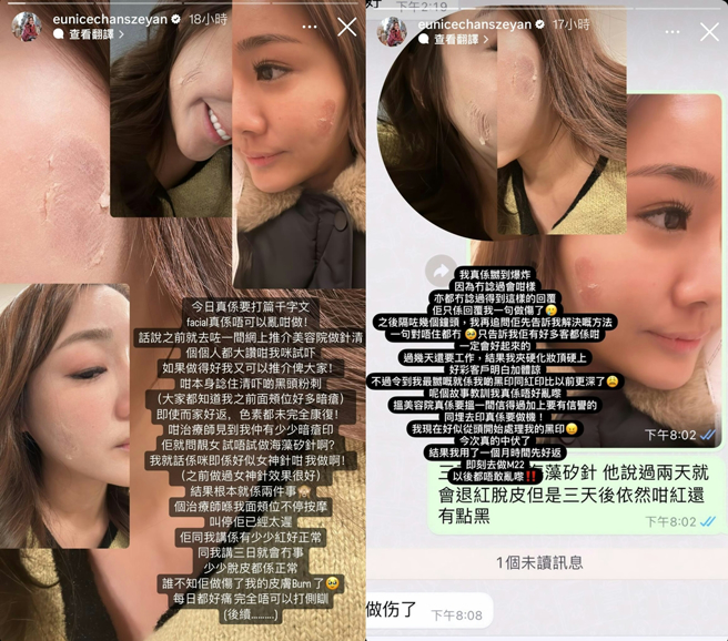 陈诗欣生气美容院一句道歉都没有。（图／翻摄自eunicechanszeyan IG）