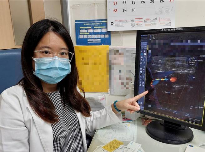 苗栗大千醫院醫師李亭儀提醒，若出現頸動脈阻塞相關症狀時，務必及早就醫接受檢查。（大千醫院提供／謝明俊苗栗傳真）