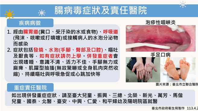 2024年4月26日台北市／一但发现婴幼儿出现嗜睡、意识不清、活力不佳、肌跃型抽搐（无故惊吓或全身肌肉突然收缩）、持续呕吐与呼吸急促或心跳加快等重症前兆病徵，请儘速送往北市14家肠病毒重症责任医院。（台北市卫生局提供／刘玮晴台北传真）