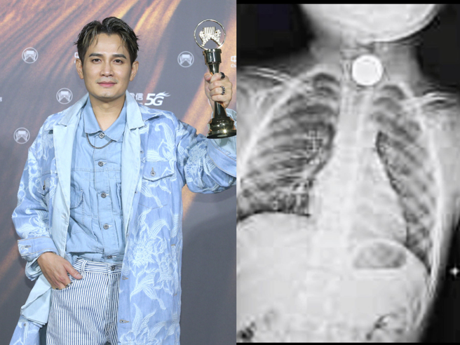 罗文裕发文透露，儿子日前误吞硬币卡在喉咙。（图／中时资料照、罗文裕脸书）