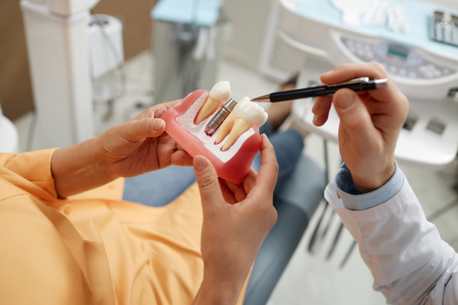 人工植牙是常见缺牙的治疗方式，但要注意的是，并非所有人都适合。（示意图：shutterstock／达志）