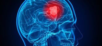 「新冠克星」mRNA 疫苗技术 将用来对付脑癌