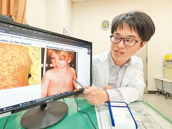 卫福部台中医院旅游门诊医师萧志毅说，麻疹传染力极强，最好的预防方式就是疫苗打好打满。（冯惠宜摄）