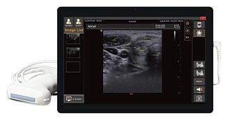 安克生醫 攻掌上型超音波商機