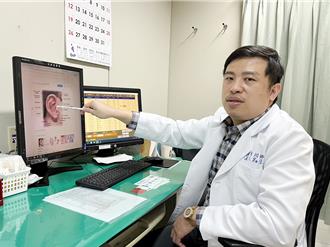 30歲女耳廓變形 取自體軟骨種真耳 化身最美新娘