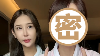 網紅砸590萬整形一堆後遺症「臉歪嘴斜」後悔嘆：沒有回頭路