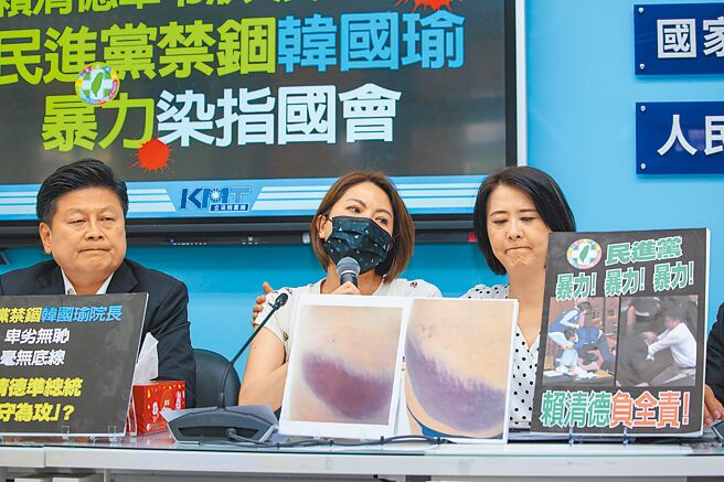 国民党团18日召开记者会，立委陈菁徽（中）现场公布验伤照片，立委王鸿薇（右）更拉起衣袖展示瘀青。（郭吉铨摄）