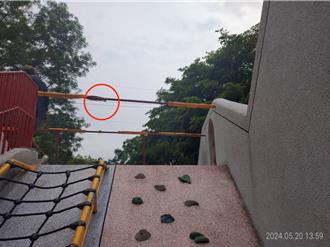 遊樂設施畫傷孩童眼睛下緣 中市議員要求改善