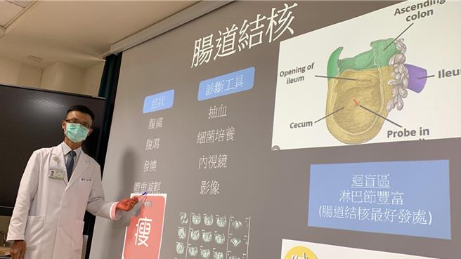 台中醫院肝膽腸胃科醫師吳明駿24日指出，結核菌感染若在肺部通常會有發燒、慢性咳嗽、怕冷等，腸道結核症狀包括腹痛、食慾不振、貧血、發燒、盜汗或體重減輕等，未感染到肺部就沒有空氣與飛沫傳染的風險。（潘虹恩攝）