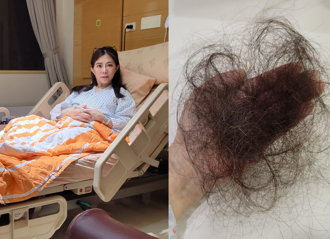 小彤力抗胰臟癌须化疗12次  曝严重副作用「快要剃度了」