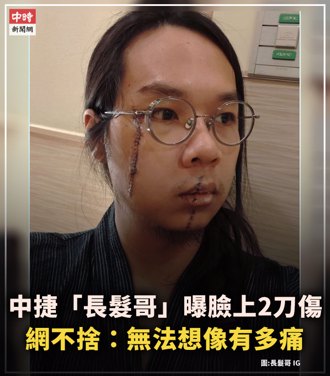 幫中捷英雄「長髮哥」免費除疤！美妝G老闆：團隊全力配合