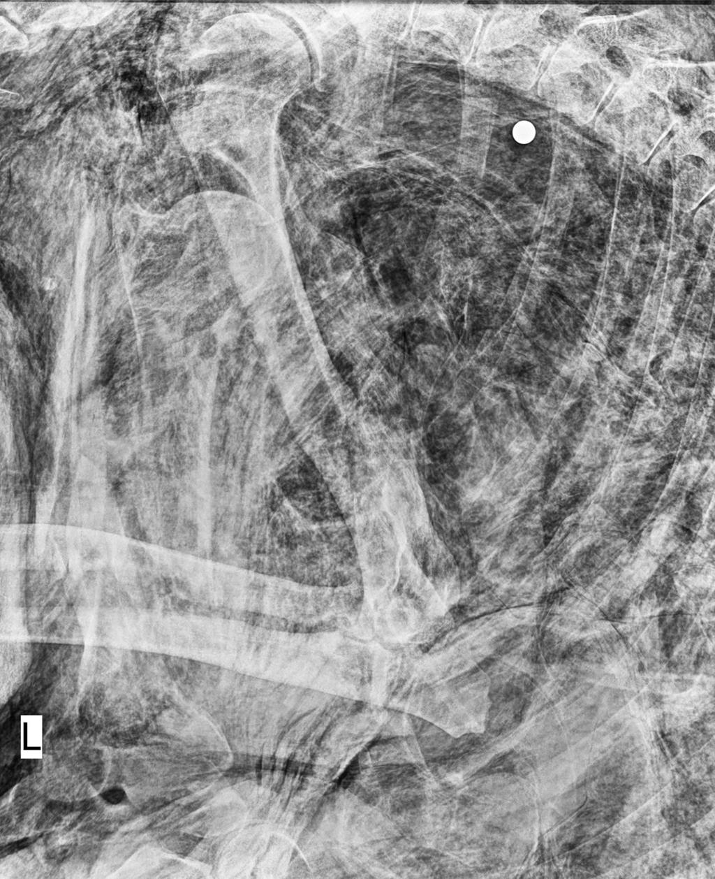 遭槍殺的台灣黑熊，經解剖發現子彈卡在左側胸腔背側，至少死亡3天以上。（玉山國家公園提供／楊靜茹南投傳真）