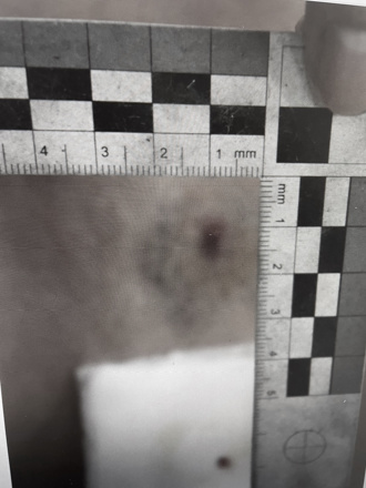 北投女突遭BB彈射擊！「大腿滲血」急報案 警擴大偵辦中