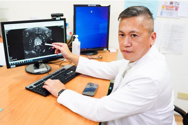 光田综合医院泌尿科主任医师卢智强指出，「摄护腺肥大」是摄护腺因年纪不断增生良性组织，但若增生的是恶性组织，就成「摄护腺癌」。（光田医院提供／张妍溱台中传真）