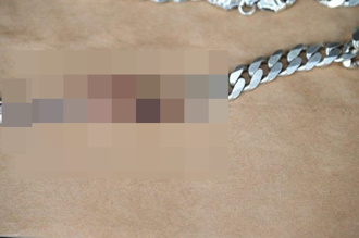 男子遭開槍頸部中彈 項鍊擋下子彈奇蹟生還