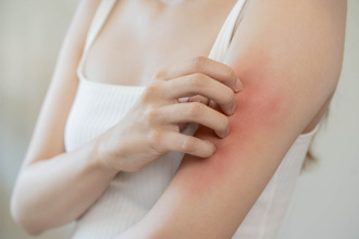 端午出遊小心5種蟲 被恙蟲咬致死率達60％ 自保措施曝