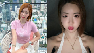 DJ SODA漂亮眼睛「突腫脹變形」本人崩潰揭原因