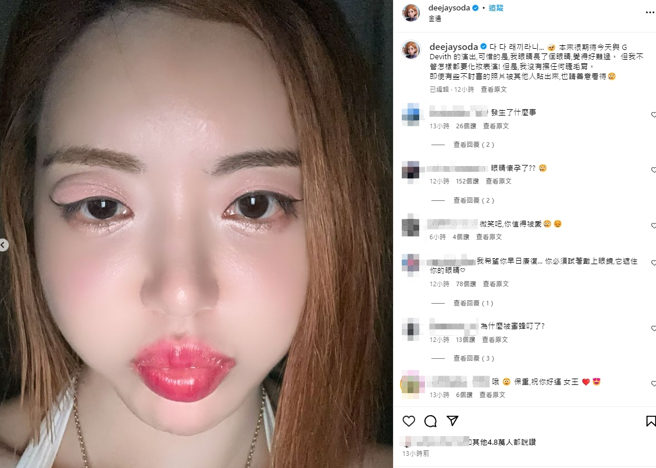 DJ SODA曝光近照，无奈右眼长针眼。（图／翻摄自IG @deejaysoda）