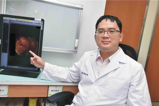彰化基督教醫院大腸直腸外科主治醫師劉佑碩表示，高齡大腸直腸癌患者，仍有機會手術治療後恢復良好生活。（彰化基督教醫院提供／孫英哲彰化傳真）