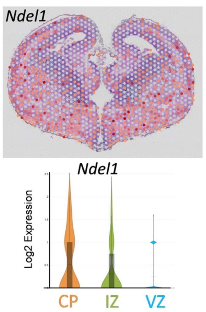 高雄長庚與陽明交大發現新平腦症致病基因NDEL1，表現在老鼠胚胎大腦的中間區和皮質區狀況。（高雄長庚提供／任義宇高雄傳真）