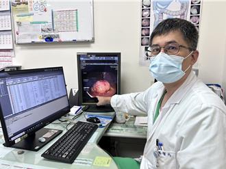 早期发现早期治疗 部苗医院5月筛出10人罹癌、7人为原位癌