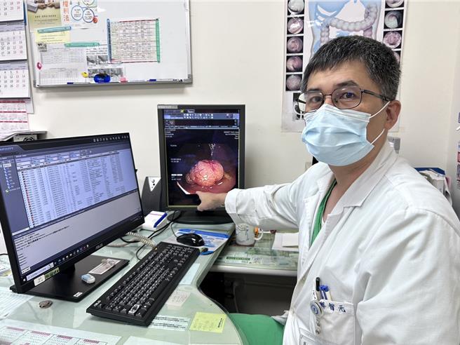 部苗外科鄭智元主任指出影像顯示大腸鏡檢查發現息肉，經切除進行病理檢查後確診原位癌。（部苗提供／李京昇苗栗傳真）