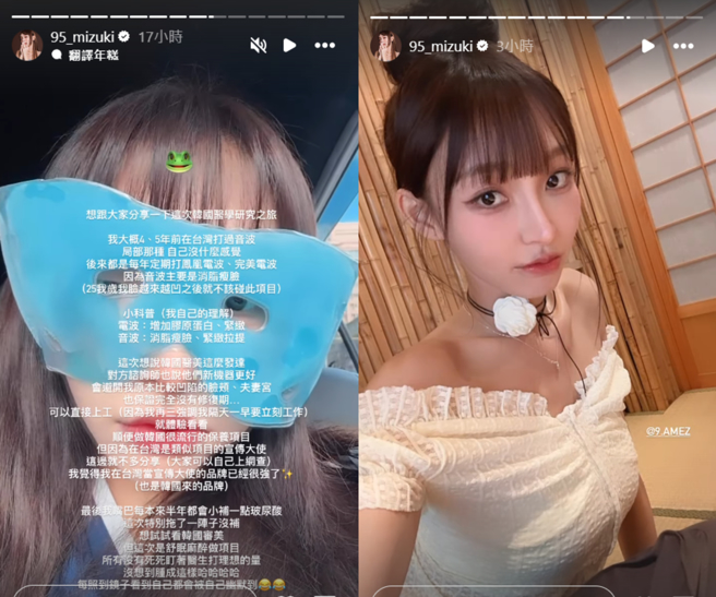 林襄赴韩打玻尿酸嘴巴肿起来，会被自己幽默到。（图／IG@95_mizuki）