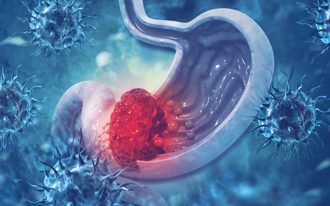 9成胃癌由幽門螺旋桿菌引起 嘉義人篩檢1／4中鏢