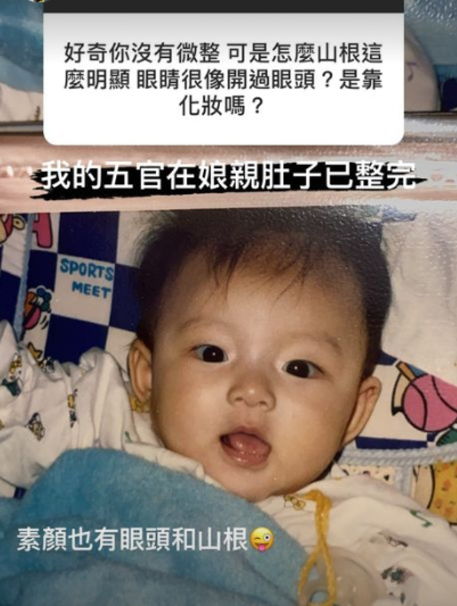 张舒晴澄清自己的五官打娘胎就没整过。（图／摄自IG shuqing0316）