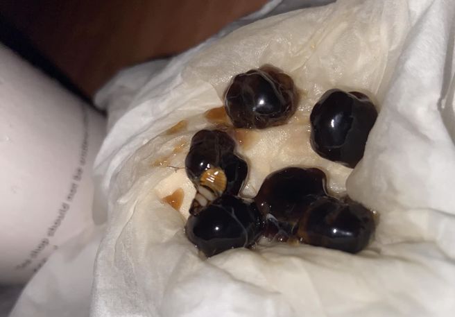 一名女自喝珍奶咬到蟑螂，引发讨论。（翻摄自爆料公社二社）