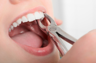 乳牙沒顧好孩童發育大打折 牙醫師警示保養3重點