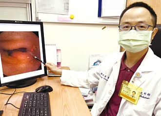 男童腹痛血便 膠囊內視鏡揪病因