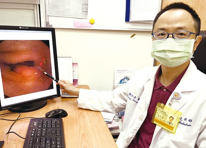 双和医院小儿消化科医师郑弘彦最近收治一名11岁男童，透过胶囊胃视镜发现远端迴肠处有梅克尔憩室肠道异常出血。（双和医院提供／王家瑜台北传真）