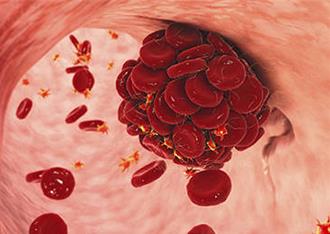 陸科學家發現治療免疫性血小板減少症突破性新療法