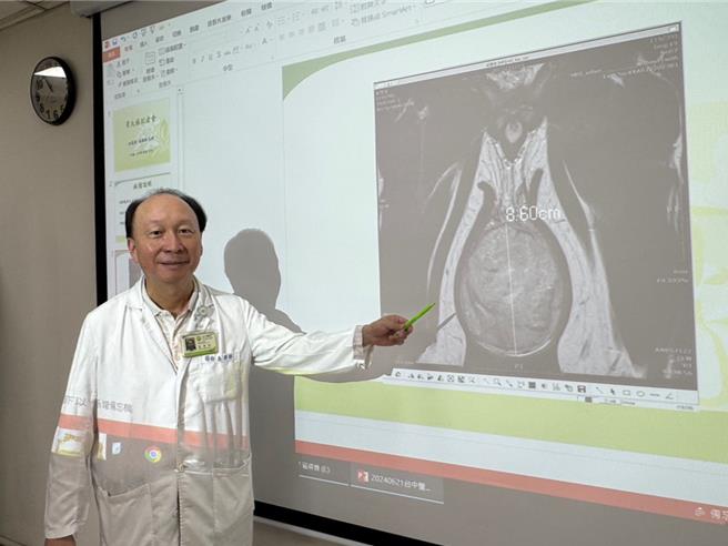 台中20岁男大生去年中发现自己右侧睪丸比左侧大，直到今年初大到连穿垮裤都藏不住才就医。台中医院泌尿科主任朱朗轩21日指出，睪丸癌较常发生于40岁以下男性，不太会感到疼痛，且不会一下子肿大。（潘虹恩摄）