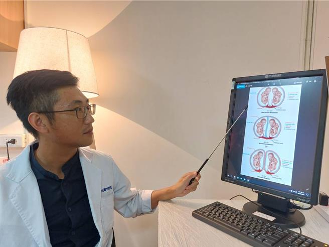 陈颖说，根据统计，因输血症候群的双胞胎的死亡率，可高达60％以上，危险性高。（图／光田综合医院）