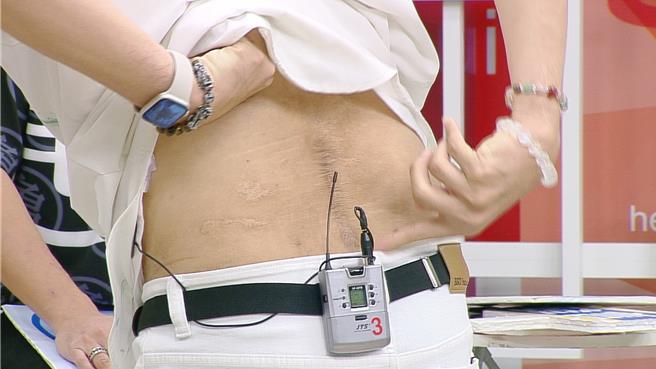 叶诺帆露出车祸疤痕。（和展影视提供）