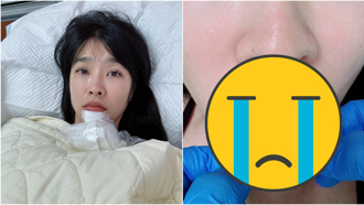 小嫻慘摔跤門牙凹陷「咬裂嘴巴爆血」緊急縫合傷勢曝光