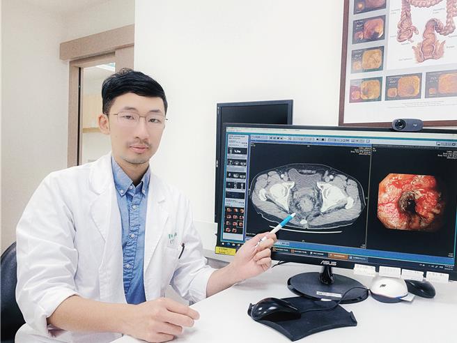 医师蔡坤佑提醒若出现便血、排便习惯改变、体重减轻、里急后重症状，应儘速就医检查。（土城医院提供）