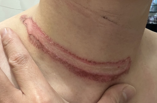 伤势照片。（图 / 民眾提供）