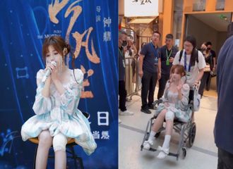 「铁肺萝莉」演出前惨遇意外　脸、腿受伤坐轮椅现身
