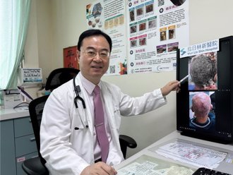 男服用標靶藥物抗癌頭皮潰爛 醫師「喊停」免植皮危機 