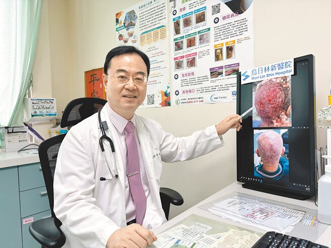 烏日林新醫院癌症中心副院長許人文12日說，口服標靶藥物對有基因突變的肺腺癌病人療效卓著，但不同的標靶藥物有它獨特的副作用，約有6至8成的病人在使用一段時間後會產生皮膚的副作用。（烏日林新醫院提供／潘虹恩台中傳真）