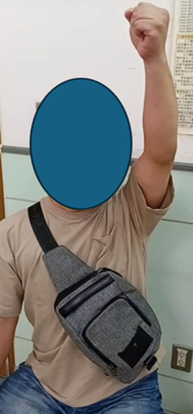 男子手术一年后，肩膀已经完全上举很有力气。（图中案例与文中案例无关。（图／黄惠鑛医师提供）