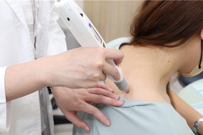 68岁蔡女士因长年劳作，时不时腰酸背痛与多处肢体酸痛，合併肾病末期，常与止痛药及酸痛药膏为伍，以雷射针灸治疗3个月大幅改善。示意图，非当事病患。（仁爱长庚合作联盟医院提供／潘虹恩台中传真）