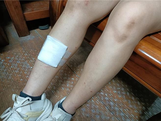 余姓女子在車禍中忍著右腳傷勢雖救出兩人，但她自責無法救出自己的愛人。（民眾提供／孫英哲彰化傳真）