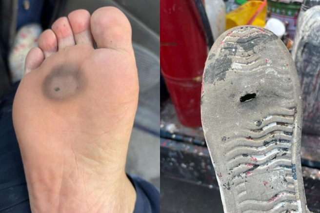 工地妹上班時腳底突然一陣刺痛，脫下鞋子發現一個洞。（翻攝爆廢1公社）