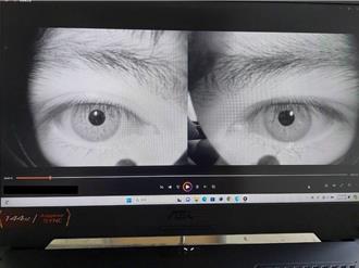 眩暈找不到原因好困擾  「眼振儀」揪病因